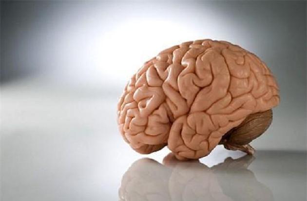 cervello 